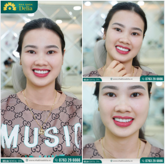 Nụ cười khỏe đẹp của chị Đỗ Thị Vân Anh (Thái Bình)