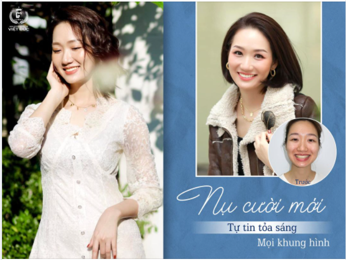 NỤ CƯỜI MỚI - THAY ĐỔI CẢ THẦN THÁI