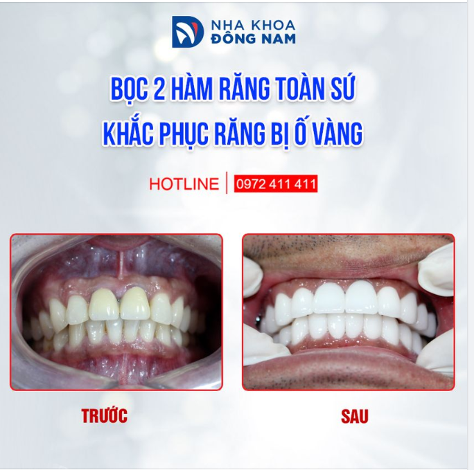 PHÁ BỎ ĐỊNH KIẾN ĐỂ CHẠM ĐẾN NỤ CƯỜI THẨM MỸ, BỀN VỮNG