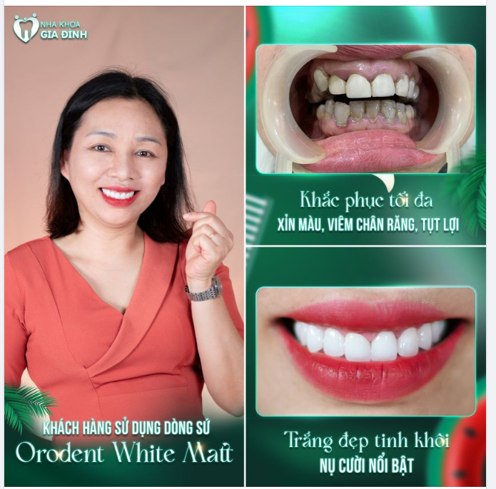 PHẢI THAY ĐỔI THÌ NỤ CƯỜI MỚI TRỞ NÊN TỰ TIN