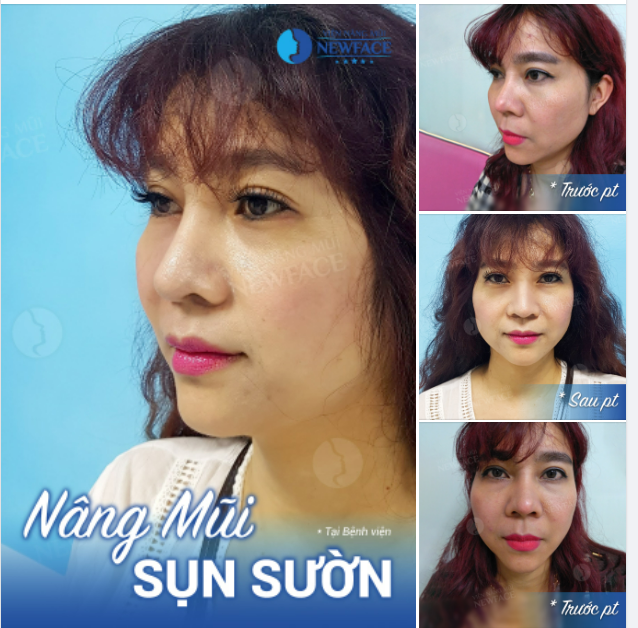 Phụ nữ, cái họ cho đi là tuổi trẻ, là sự hy sinh. Còn đàn ông, cái họ muốn mua nhất chính là thanh xuân.