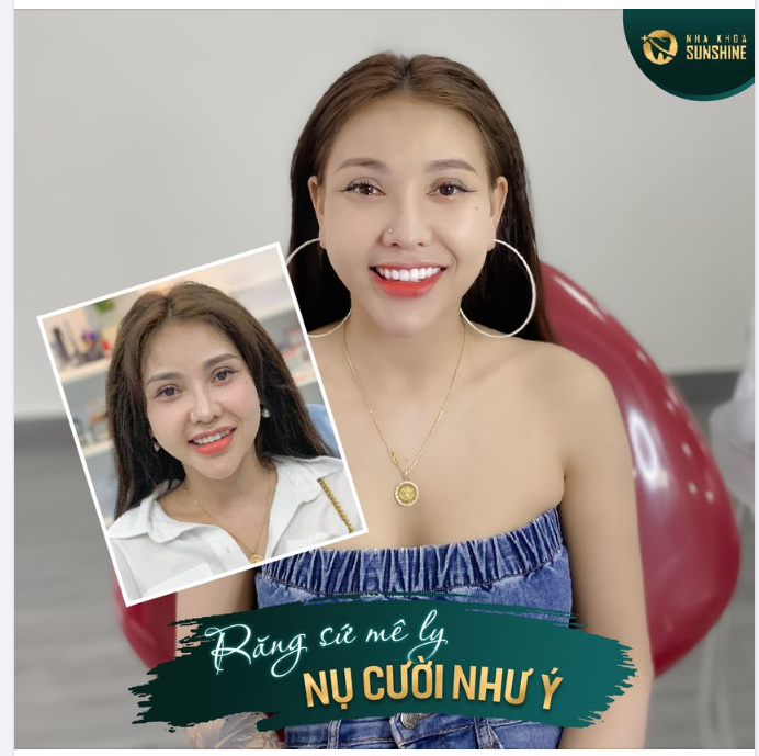 Phương pháp làm răng sứ thẩm mỹ với những ưu điểm vượt trội đã chinh phục được hàng ngàn khách hàng có mong muốn thay đổi hàm răng nhiều khuyết điểm.