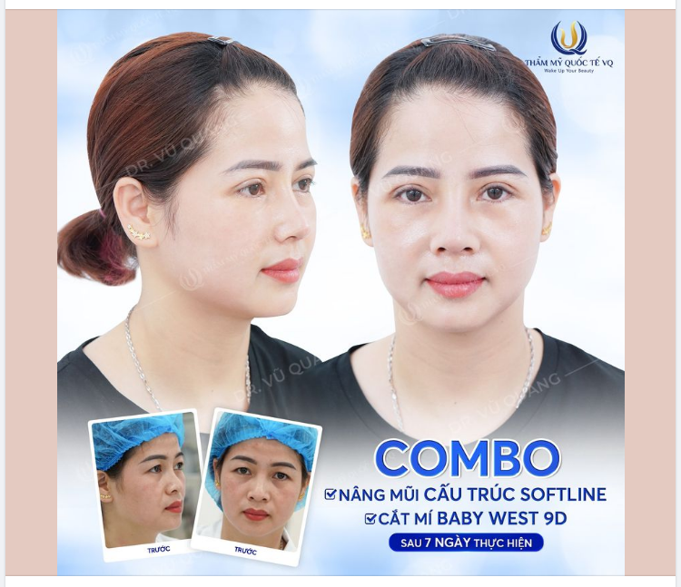 Qua rồi thời hồng nhan bạc phận - bây giờ là HỒNG NHAN BẠC TỶ nhé!