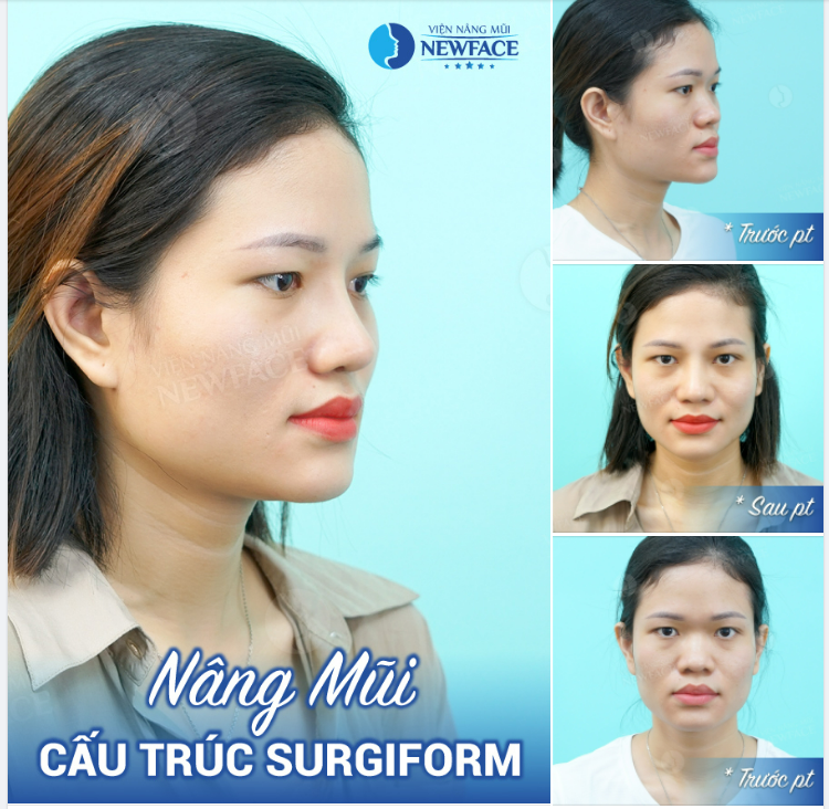 Qua sông thì phải luỵ thuyền. Em chỉ luỵ tiền việc gì phải luỵ ai…!