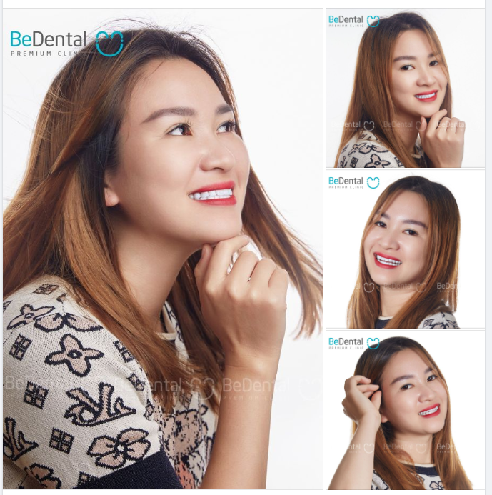 Quyết định sáng suốt của chị là đặt niềm tin vào Bedental