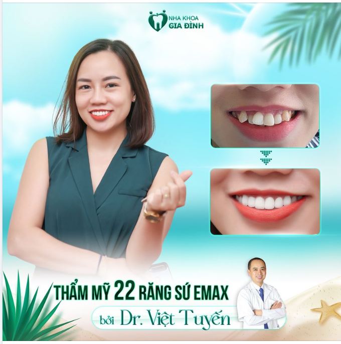 RĂNG ĐẸP KHÔNG KHUYẾT ĐIỂM CHỈ SAU 2 NGÀY