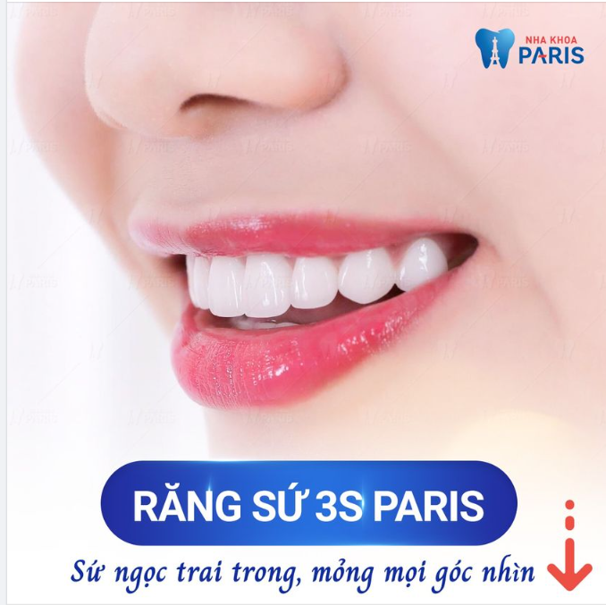 RĂNG SỨ NGỌC TRAI ĐẸP KHÔNG TÌ VẾT DƯỚI MỌI GÓC NHÌN