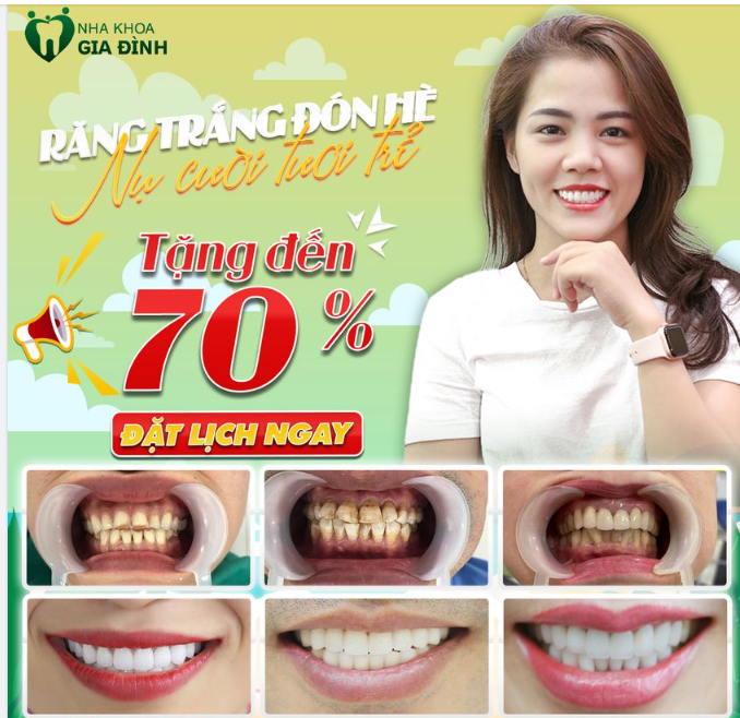 RĂNG TRẮNG ĐÓN HÈ - RẠNG NGỜI, TƯƠI TRẺ