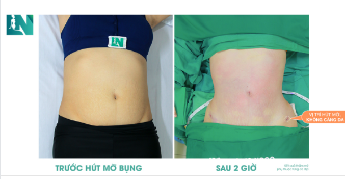SAU 2 GIỜ - SỞ HỮU VÒNG EO ƯỚC MONG