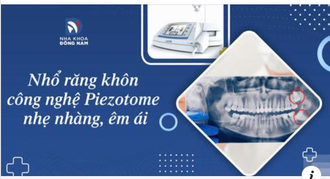 SỢ NHỔ RĂNG KHÔN ĐAU LÀ DO BẠN CHƯA BIẾT ĐẾN CÔNG NGHỆ NHỔ RĂNG PIEZOTOME HẠN CHẾ XÂM LẤN TỐI ĐA