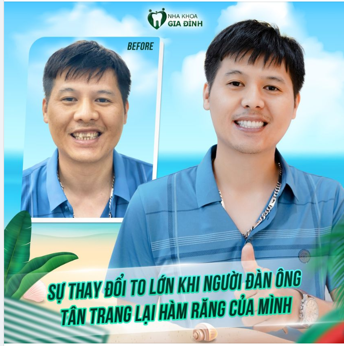 SỰ KHÁC BIỆT CỦA NGƯỜI ĐÀN ÔNG KHI THAY MỚI NỤ CƯỜI