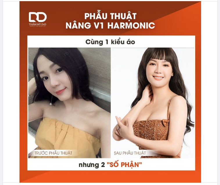 SỰ KHÁC BIỆT RÕ RÀNG, CHỨNG MINH TẦM QUA TRỌNG CỦA V1.