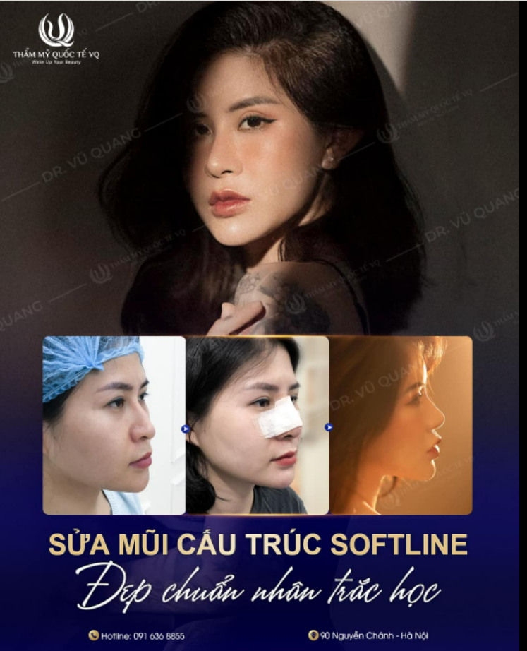 Sửa mũi cấu trúc Softline - Tạo hình dáng mũi đẹp chuẩn nhân trắc học - Thoải mái vặn vẹo, không lo lệch dáng.