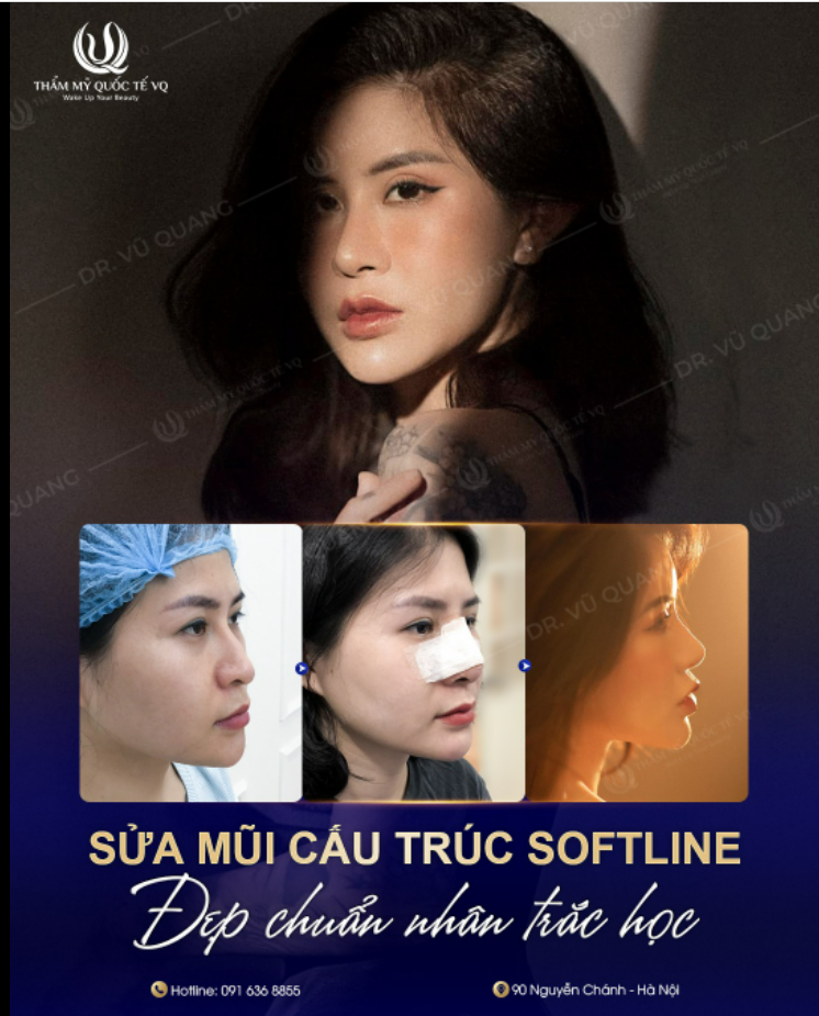 Sửa mũi đẹp thôi là chưa đủ ​​​​​​​ Sửa mũi an toàn và đẹp chuẩn nhân trắc học mới là vẹn toàn.