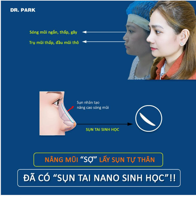 SỤN TAI NANO SINH HỌC ĐƯỢC TẠO RA VÌ ĐIỀU GÌ