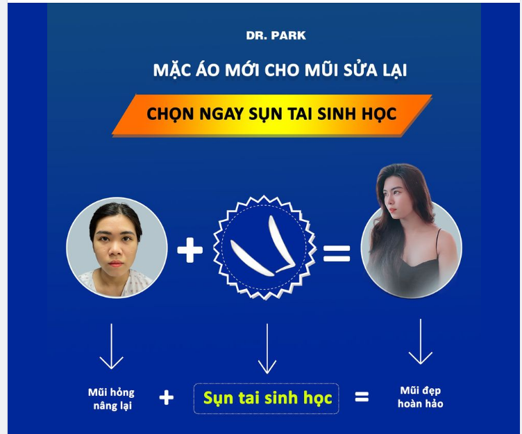 SỤN TAI SINH HỌC GIÚP GÌ CHO MŨI SỬA LẠI