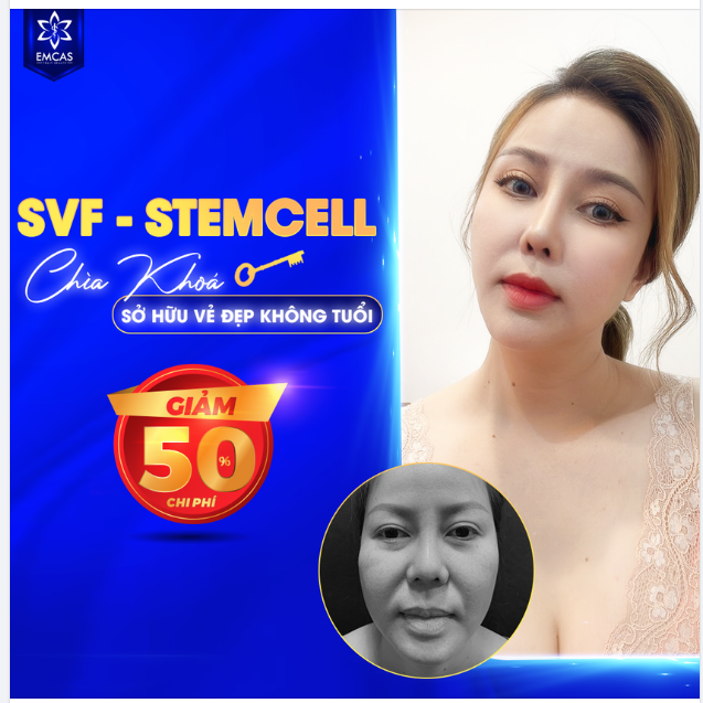 SVF-STEMCELL - CHÌA KHÓA SỞ HỮU VẺ ĐẸP KHÔNG TUỔI
