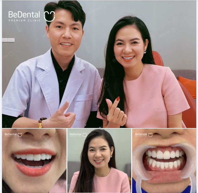 Tại Bedental, bạn sẽ nhận được chế độ chăm sóc và đồng hành cùng khách hàng trọn đời sau làm răng.