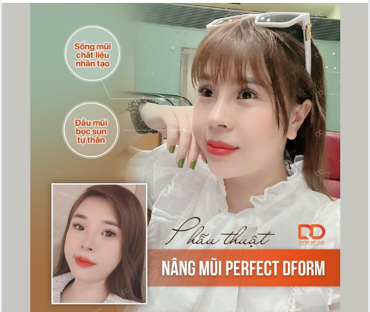 TẠI SAO NÂNG MŨI PERFECT DFORM LUÔN ĐƯỢC YÊU THÍCH