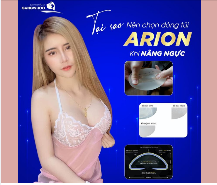 TẠI SAO NÊN CHỌN DÒNG TÚI ARION KHI NÂNG NGỰC