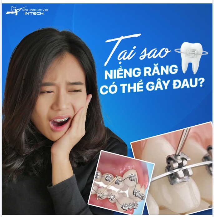 TẠI SAO NIỀNG RĂNG CÓ THỂ GÂY ĐAU?