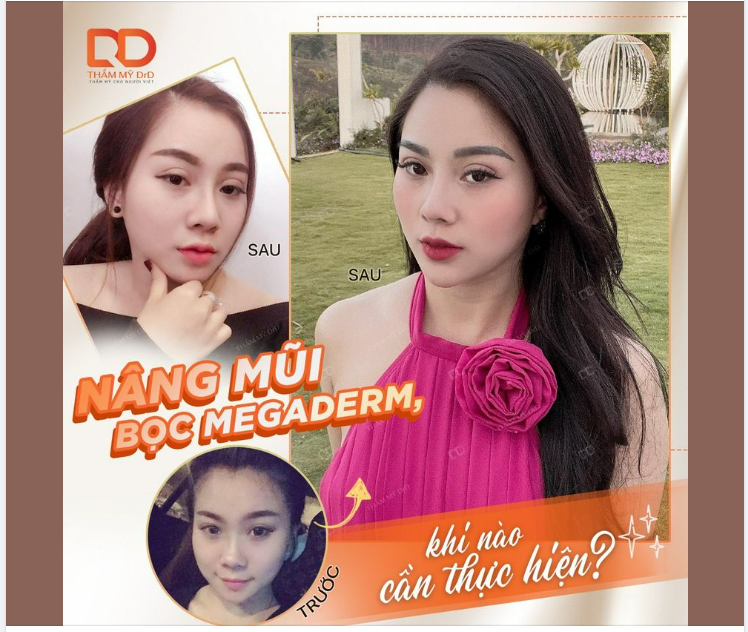 TẤM ĐỆM MEGADERM NHỎ NHƯNG CÓ VÕ.