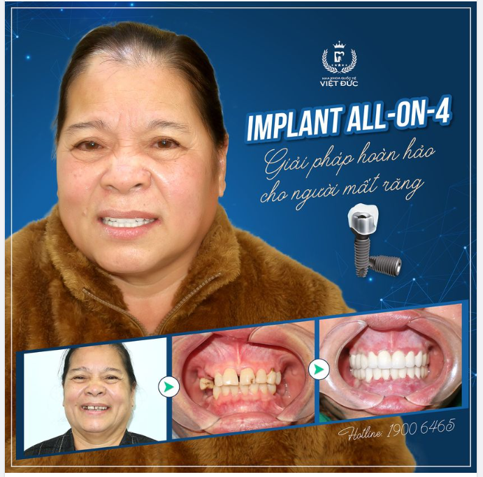 TẶNG MẸ SỨC KHỎE, TẶNG MẸ MỘT ĐỜI ĂN NGON