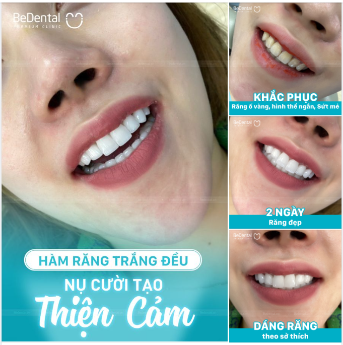 Tạo nụ cười thiện cảm với người đối diện chỉ trong một nốt nhạc