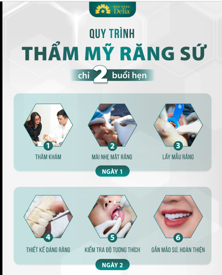 THẨM MỸ RĂNG SỨ DELIA - QUY TRÌNH TIÊU CHUẨN CHÂU ÂU