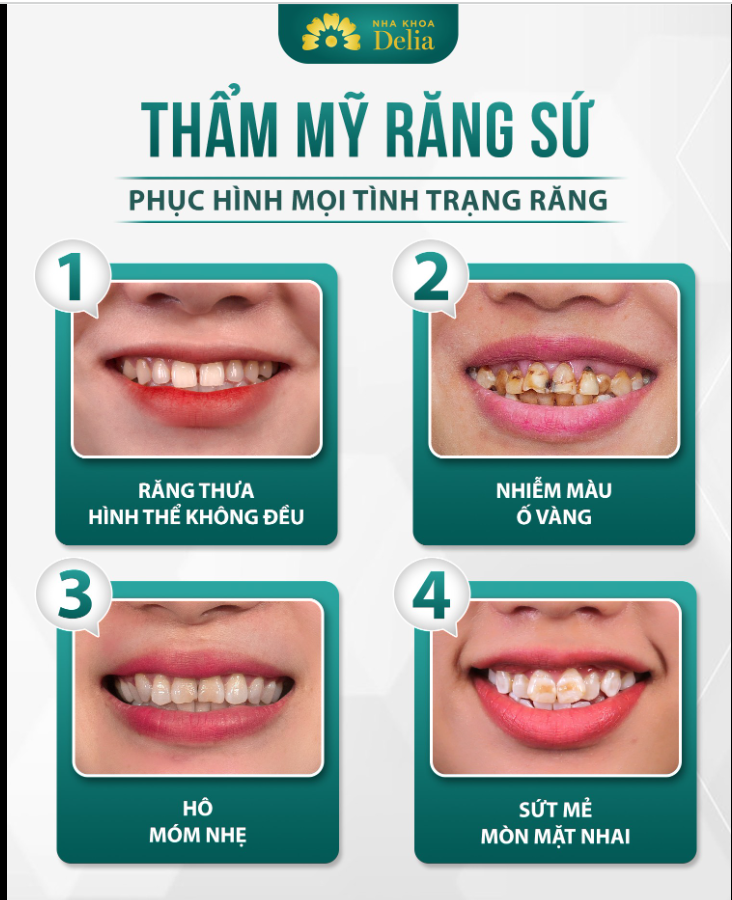 Thẩm mỹ răng sứ là phương pháp phục hình phù hợp nhất.