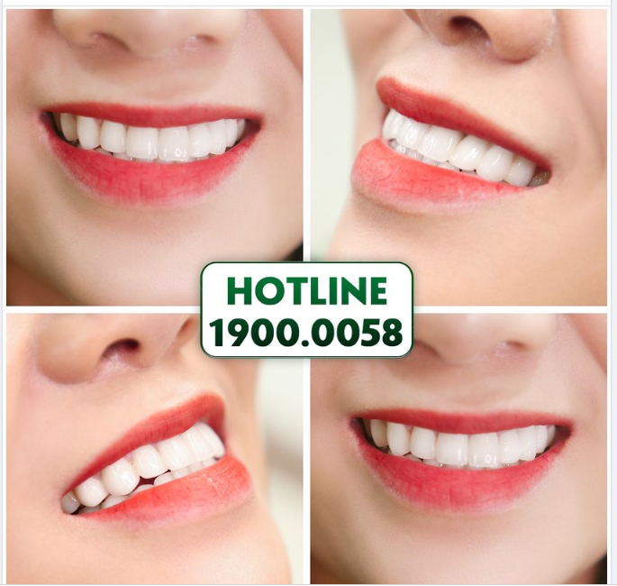 Thẩm mỹ răng tại Nha khoa Gia Đình cũng luôn chiếm được cảm tình của khách hàng nhờ có những kết quả  Người thật Việc thật