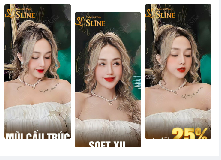 Tháng vàng cho nàng làm đẹp. Giảm đến 25% cho dịch vụ nâng mũi cấu trúc.