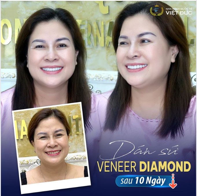 THAY ÁO MỚI CHO NỤ CƯỜI
