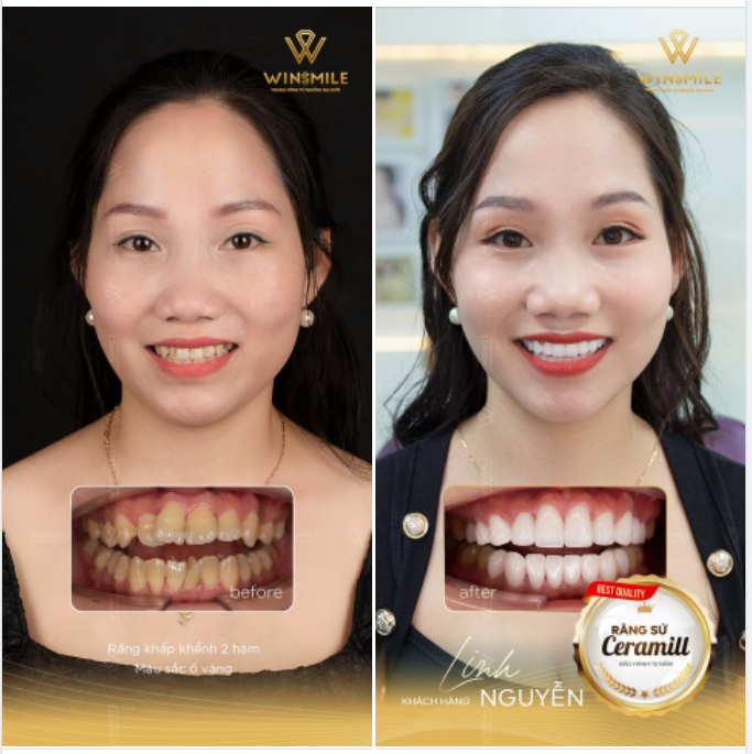 THAY ĐỔI THẦN THÁI, TỰ TIN NGẬP TRÀN