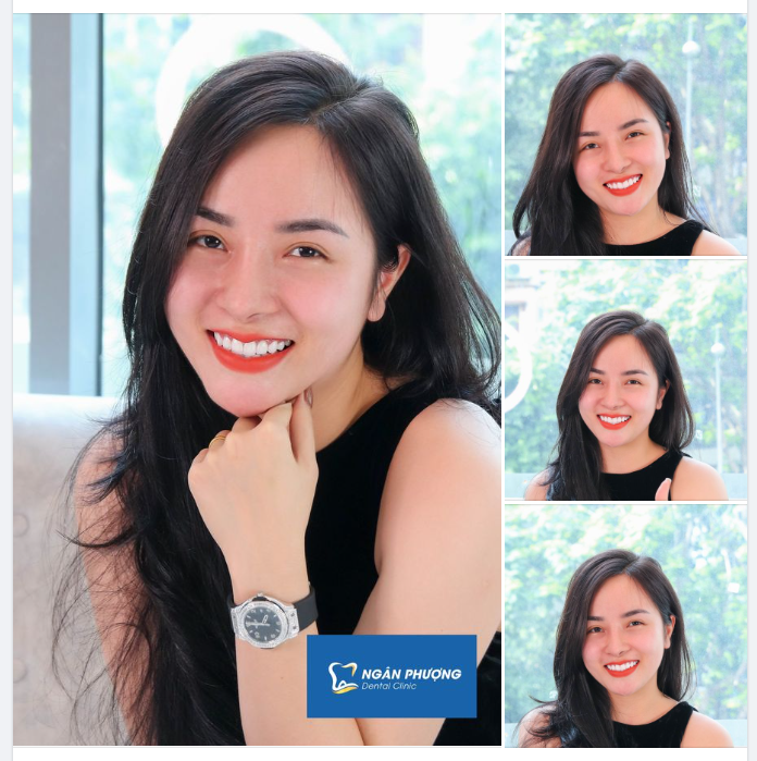 Thì ra, mùa xuân, hoa nở, là vì nụ cười em