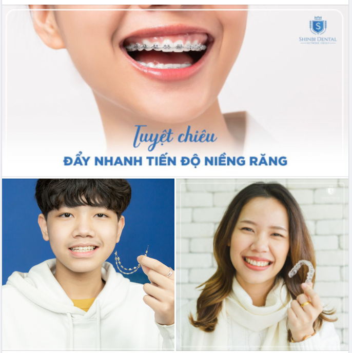 THỰC HIỆN NHỮNG ĐIỀU NÀY THỜI GIAN CHỈNH NHA ĐƯỢC RÚT NGẮN HƠN RẤT NHIỀU