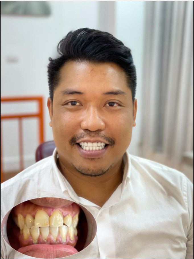 Thưởng cho bản thân một nụ cười, để trái tim bao dung rộng mở…
