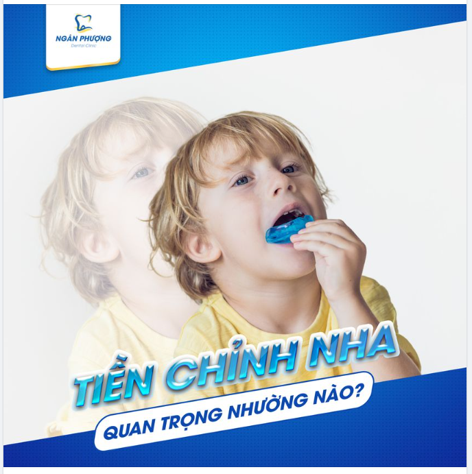 TIỀN CHỈNH NHA CHO BÉ - BÉ KHỎE, MẸ AN TÂM