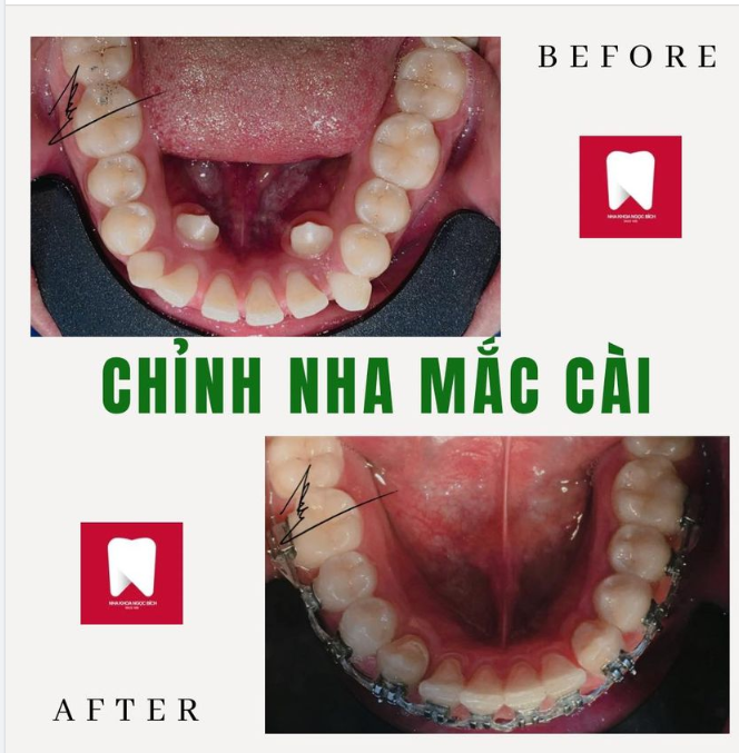 TIẾT KIỆM CHI PHÍ - KẾT QUẢ NHƯ Ý