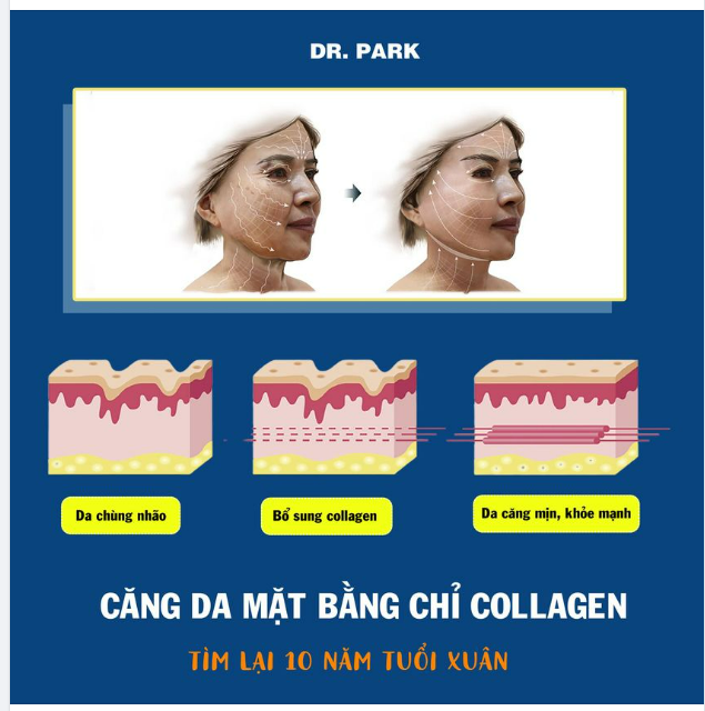 TÌM LẠI LÀN DA TƯƠI TRẺ VỚI CĂNG DA MẶT BẰNG CHỈ COLLAGEN