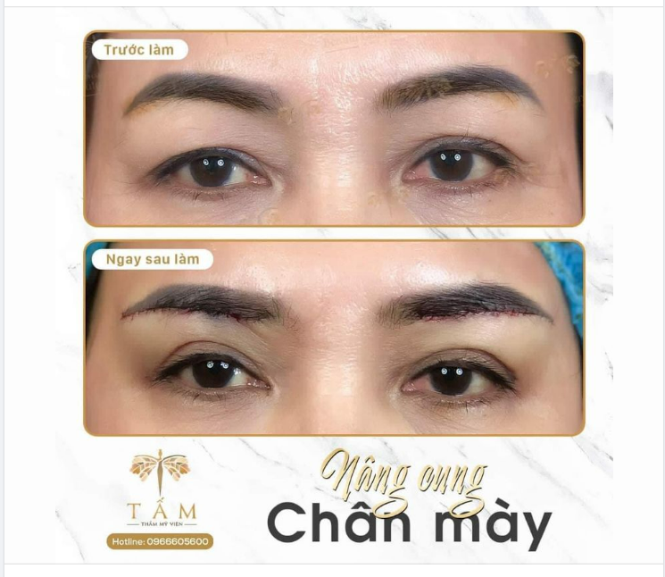 TÌM LẠI “NÉT XUÂN” CHO ĐÔI MẮT NHỜ DỊCH VỤ NÂNG CUNG CHÂN MÀY KHÔNG SẸO