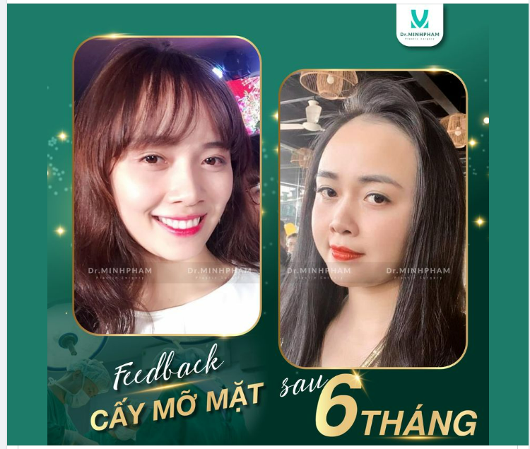 Trăm nghe không bằng một thấy, trăm thấy không bằng một làm