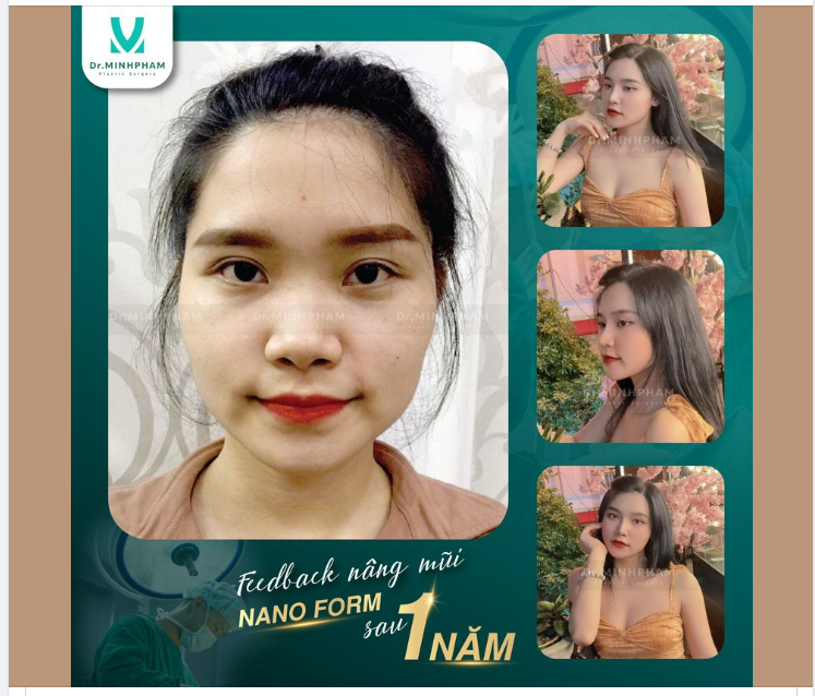 Trăm nghe không bằng một thấy, trăm thấy không bằng một làm
