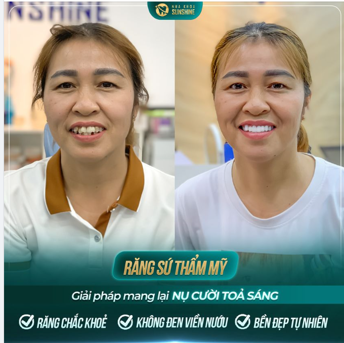 Trao cho Sunshine 10% sự tin tưởng, Sunshine sẽ trao lại bạn 90% sự hài lòng