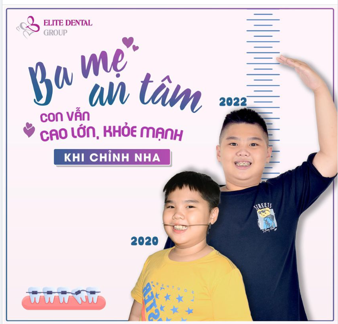 Trẻ mang khí cụ chỉnh nha có đau không, có lớn được không, có ảnh hưởng đến học tập hay quá trình phát triển thể chất của con không?