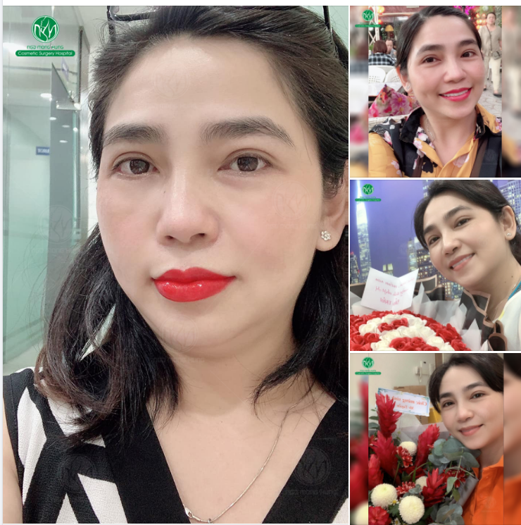 TRẺ TRUNG VỚI ĐÔI MẮT 2 MÍ ĐỀU ĐẸP