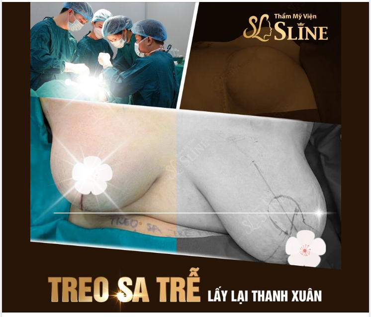TREO NGỰC SA TRỄ - LẤY LẠI THANH XUÂN