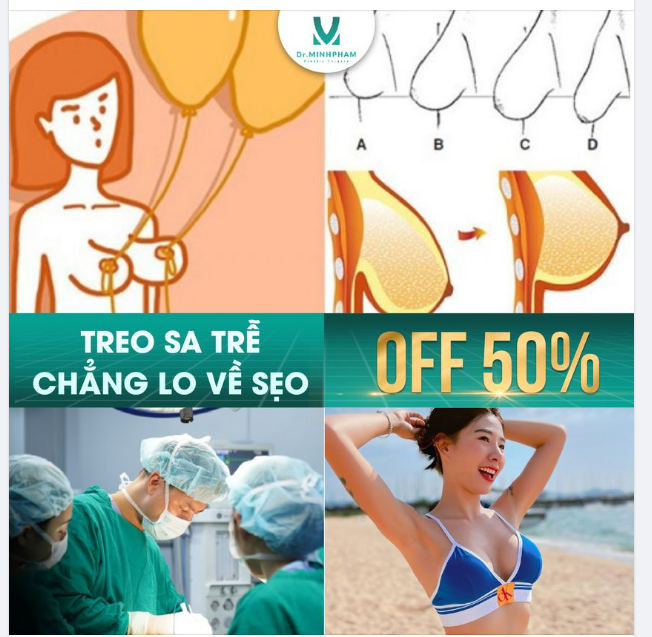 Treo sa trễ - Chẳng lo về sẹo. Hết chảy xệ, sa trễ chỉ sau 90p đến với Dr. Minh Phạm