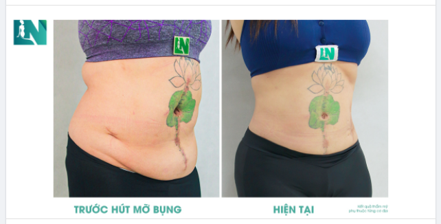 TRỞ VỀ ĐÚNG DÁNG VÓC ƯỚC MONG