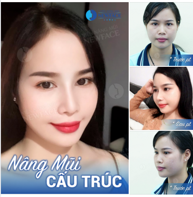 Trời xanh gió mát chẳng ngừng. Anh không để ý coi chừng mất em…!